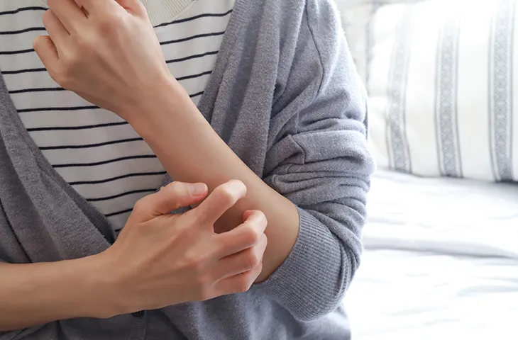 腕をかく女性の画像