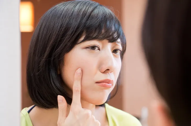 鏡を見ながらイボを気にする女性の画像